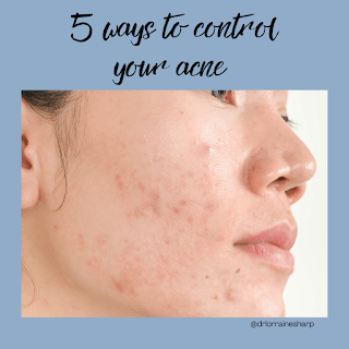 Face showing moderate comedonal acne